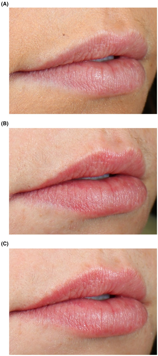 FIGURE 2