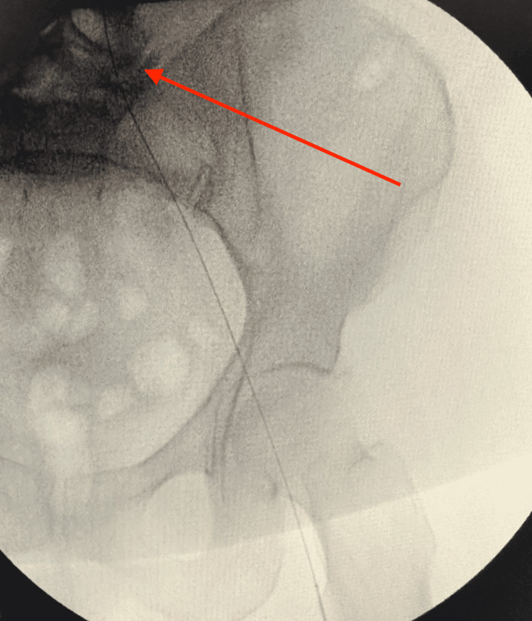 Figure 6