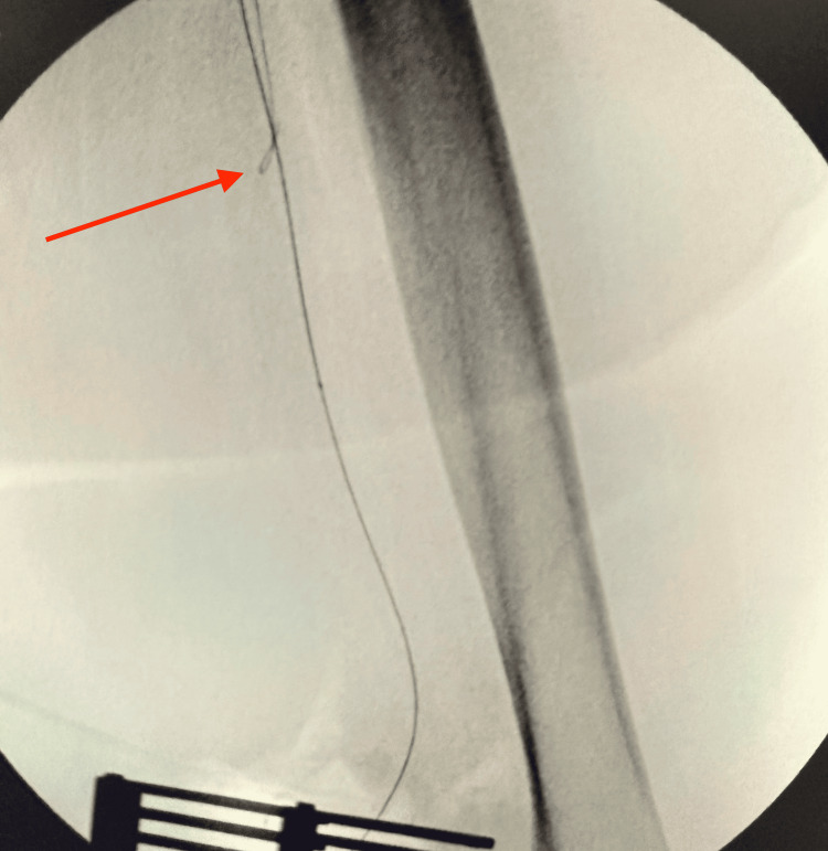 Figure 9