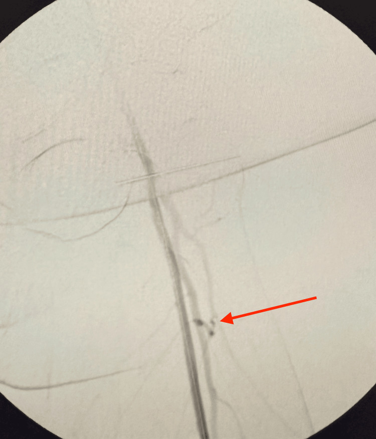 Figure 11