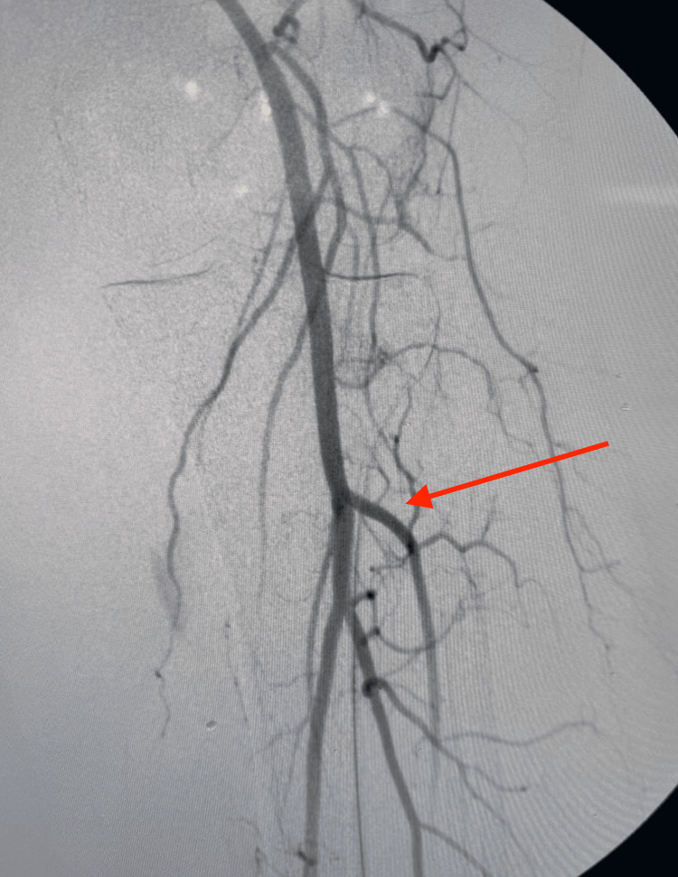 Figure 13