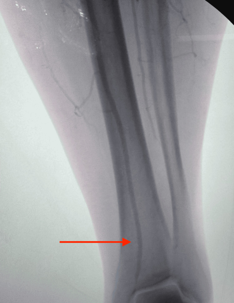 Figure 14