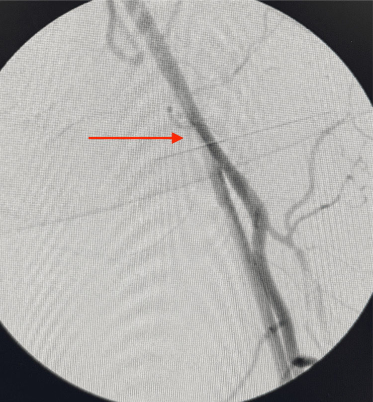 Figure 15