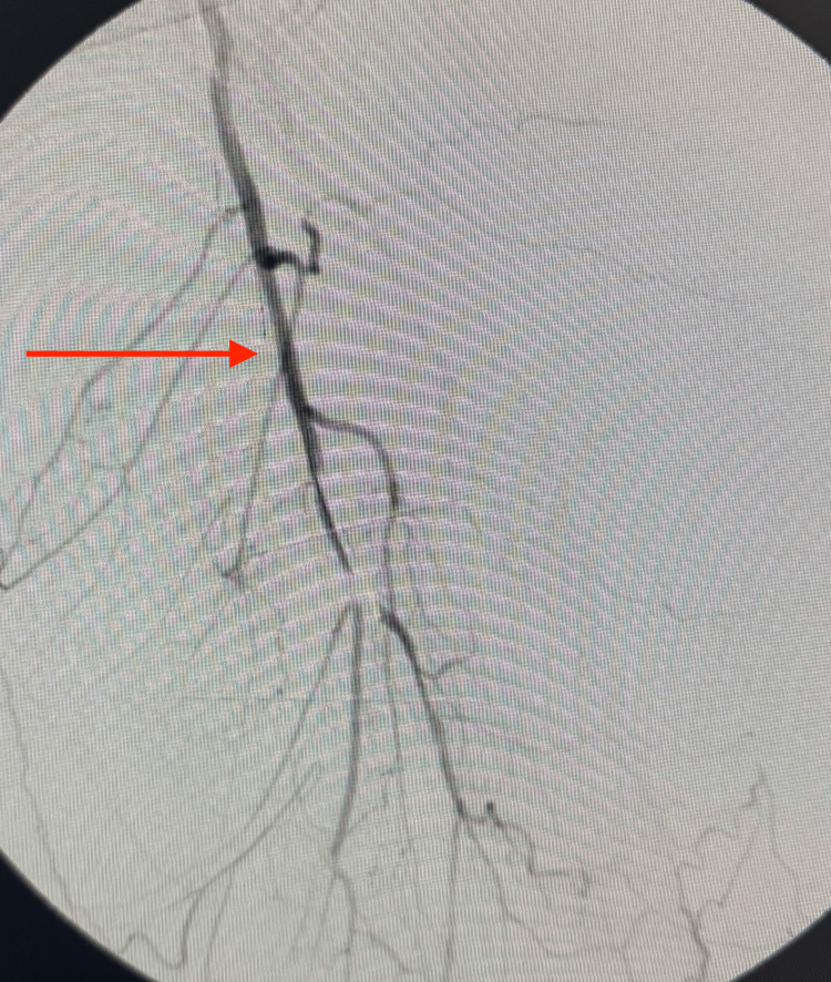 Figure 16