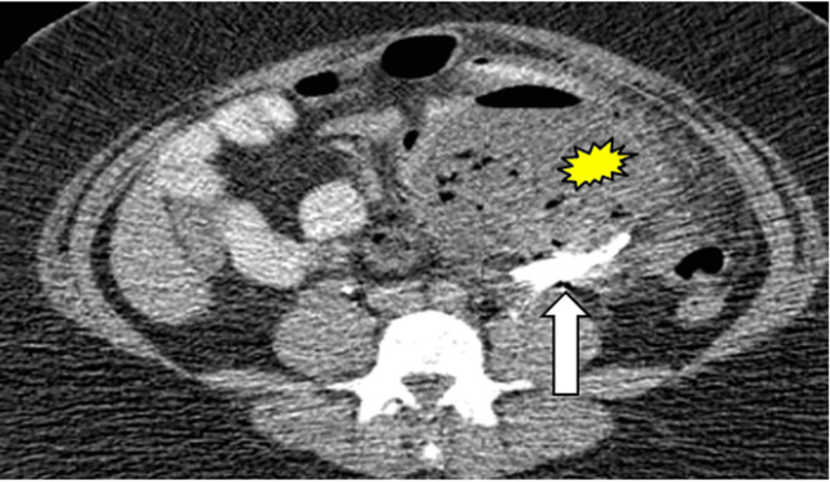 Figure 9