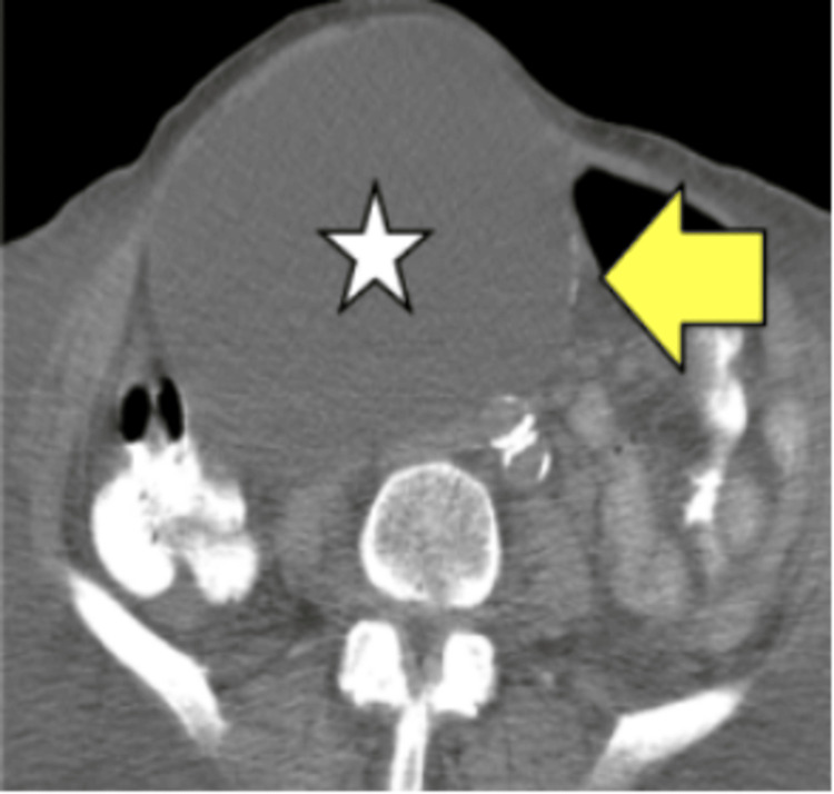 Figure 11