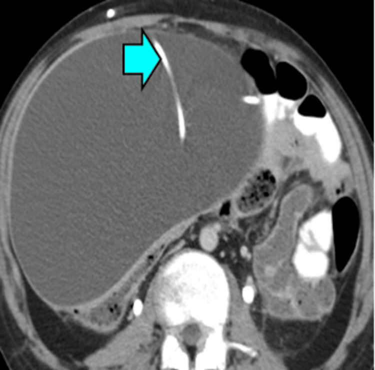 Figure 12