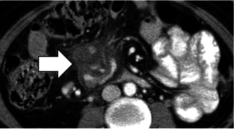 Figure 17