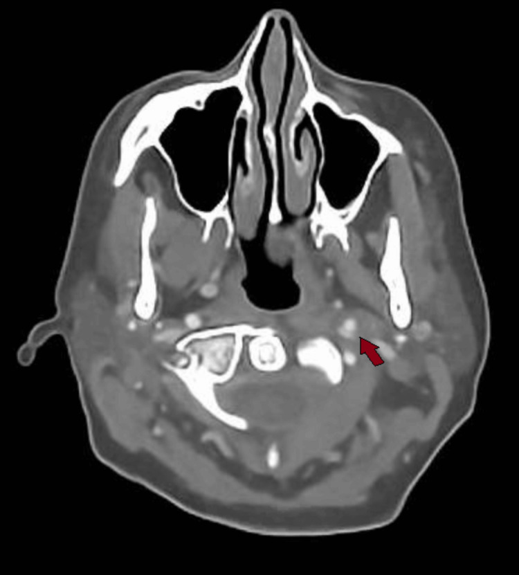 Figure 5