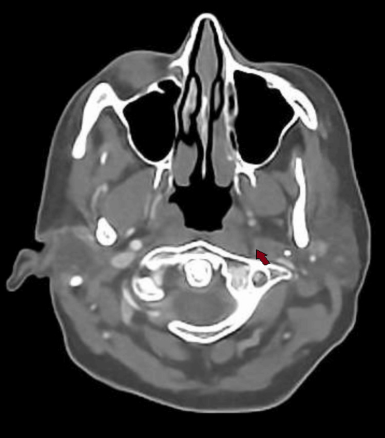Figure 6
