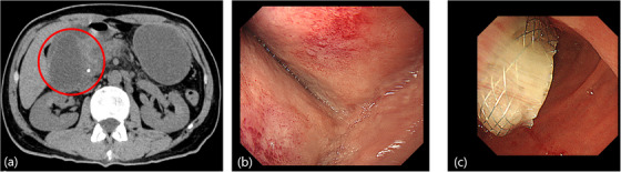 FIGURE 1