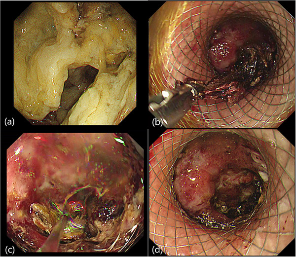 FIGURE 3