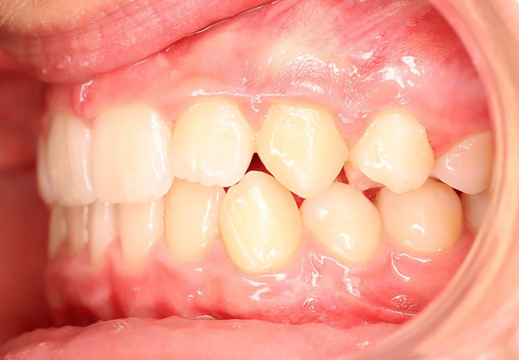 Figure 14