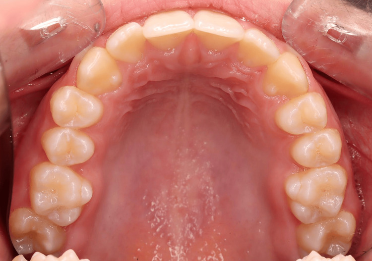 Figure 15
