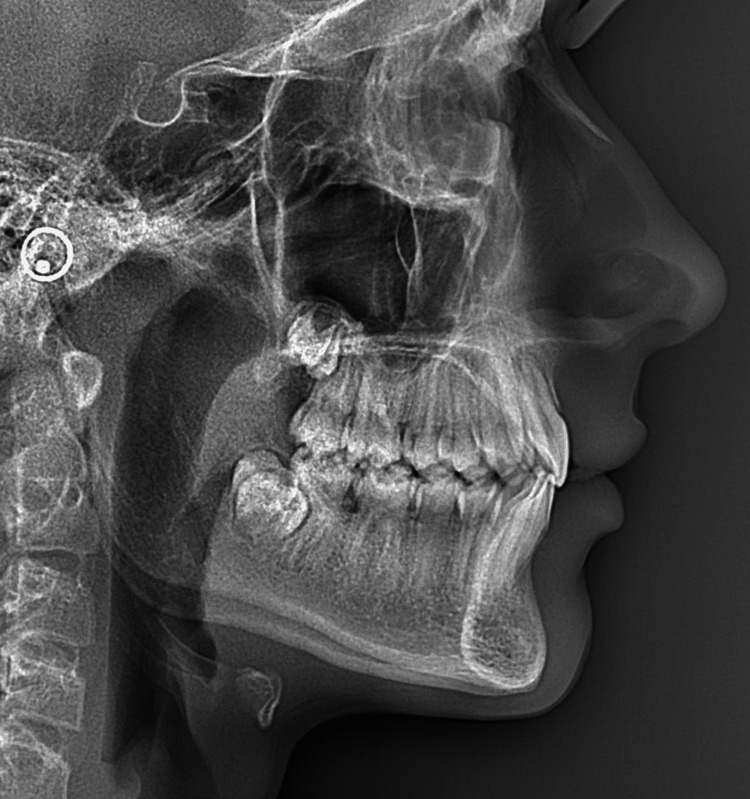 Figure 17