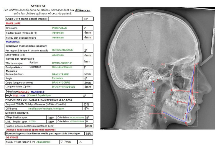 Figure 18