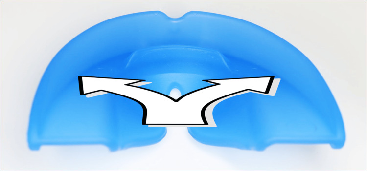 Figure 20