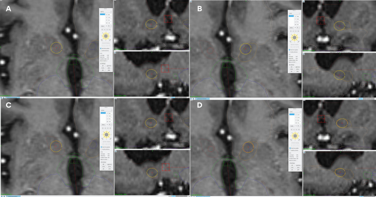 Figure 10