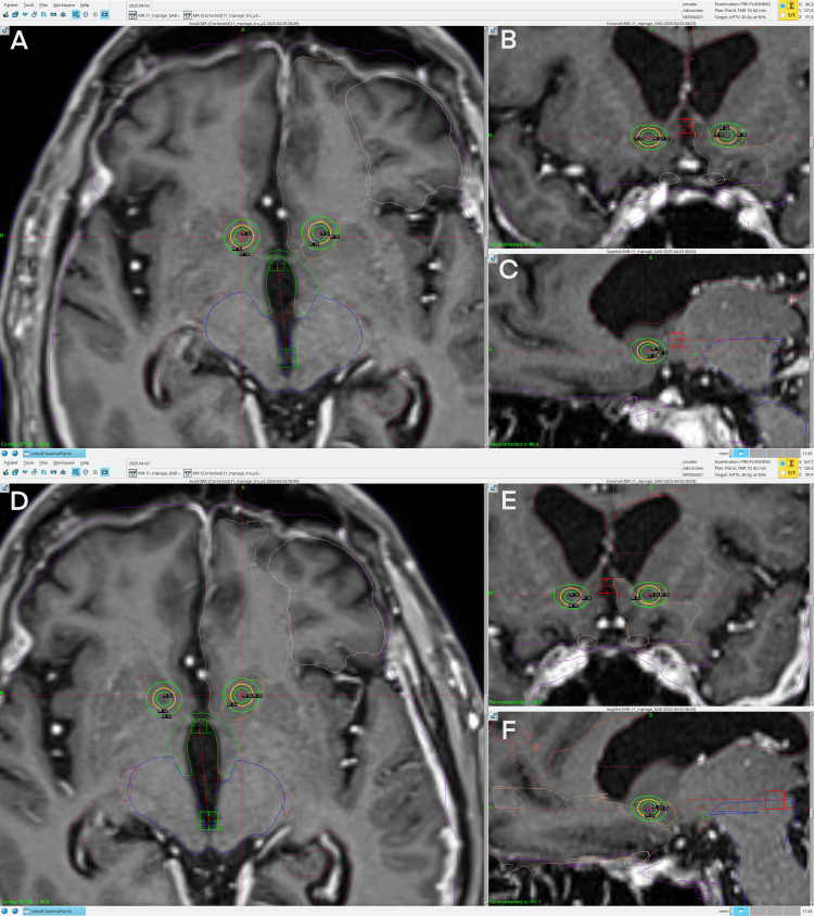 Figure 11