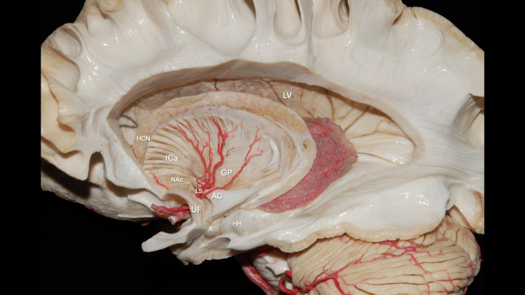Figure 12