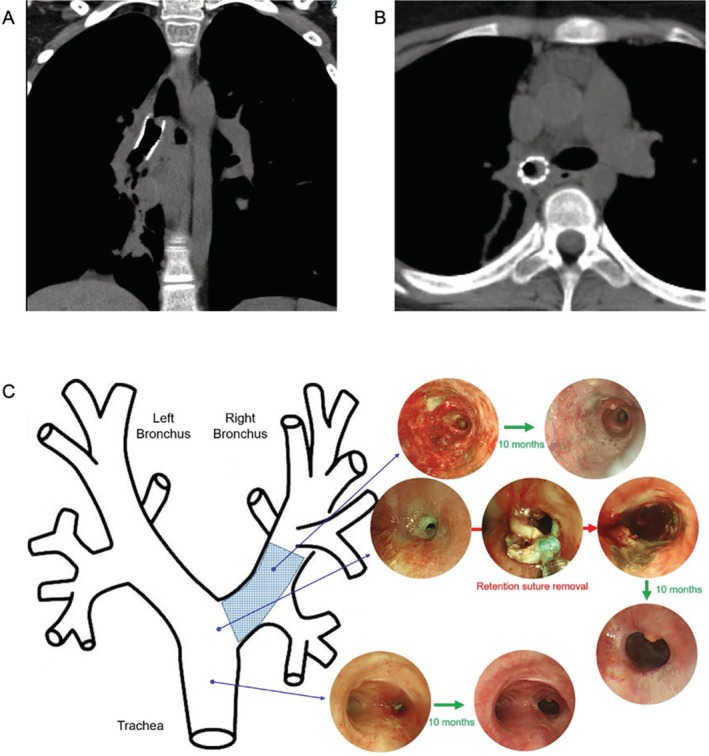 FIGURE 3