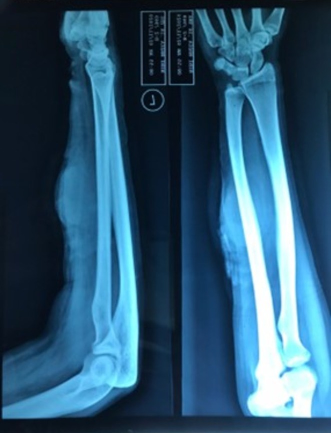 FIGURE 2