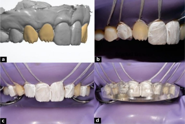 FIGURE 12