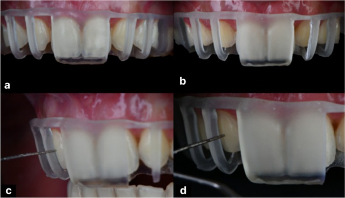 FIGURE 10