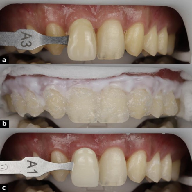 FIGURE 4