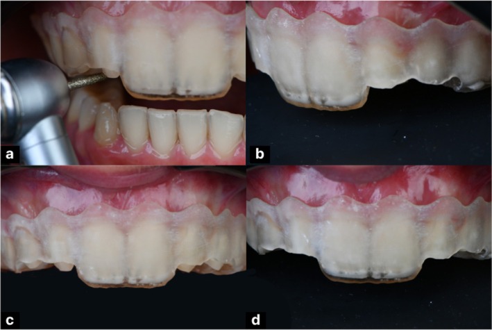 FIGURE 9