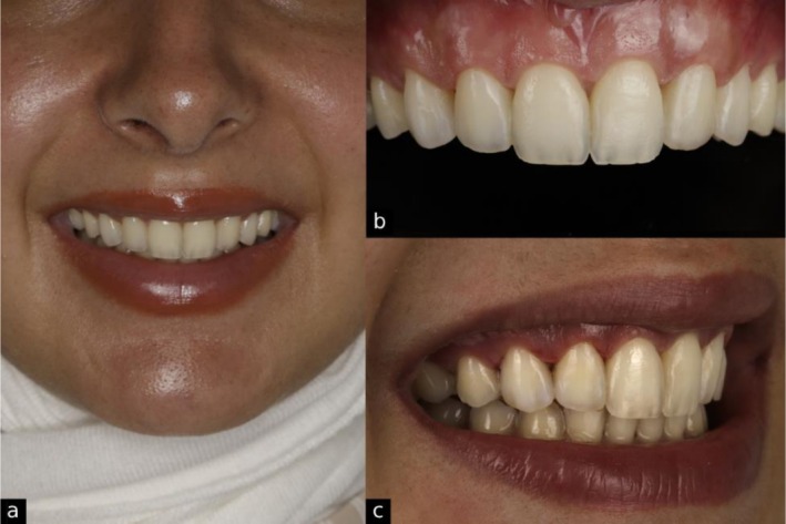 FIGURE 14