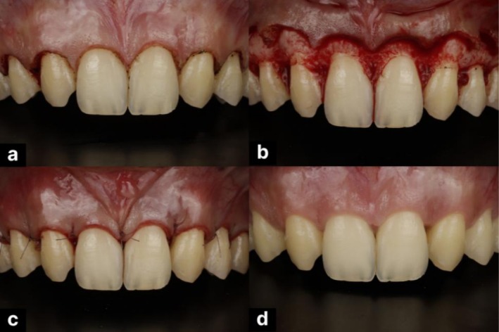 FIGURE 2