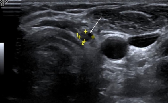 Figure 2