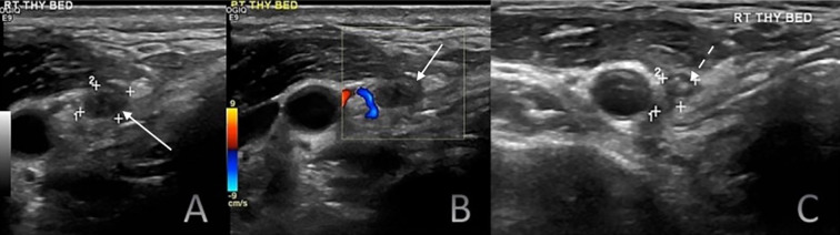 Figure 4