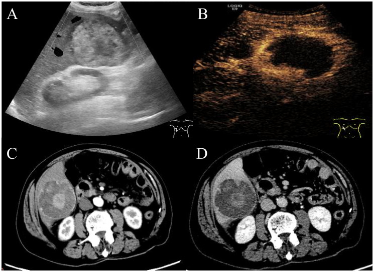 Figure 1