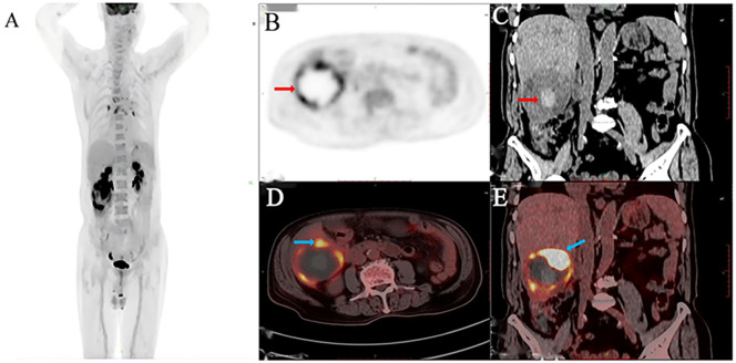Figure 2