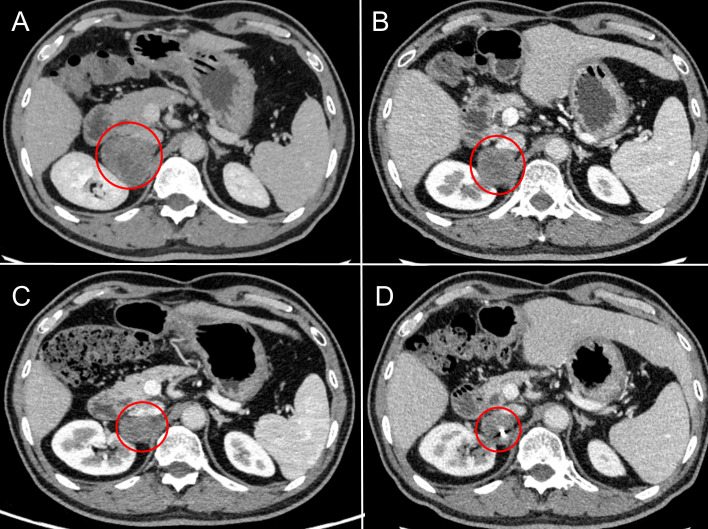 Figure 2
