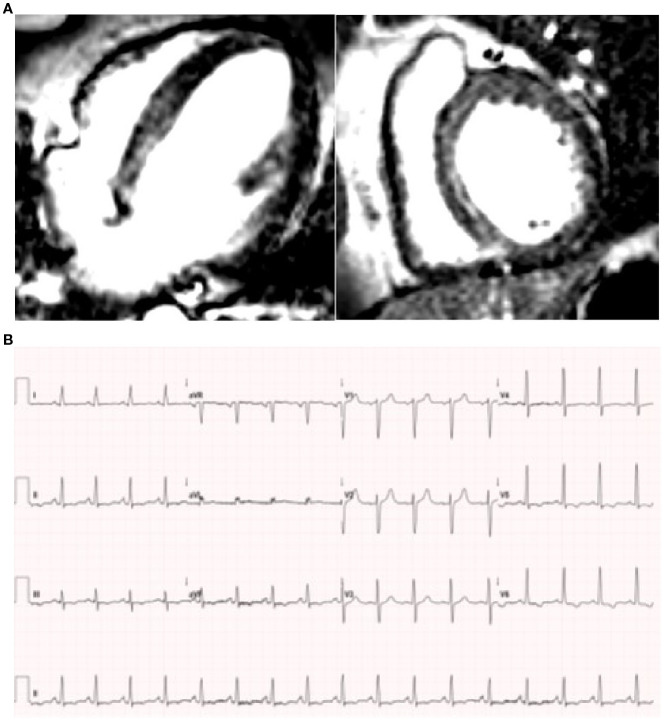 Figure 2