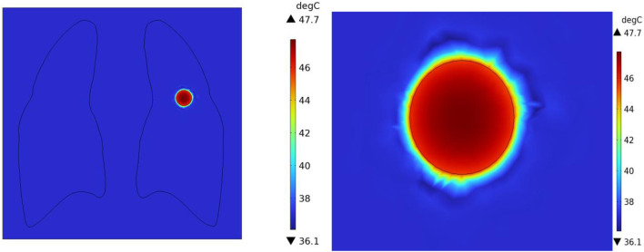 FIGURE 14