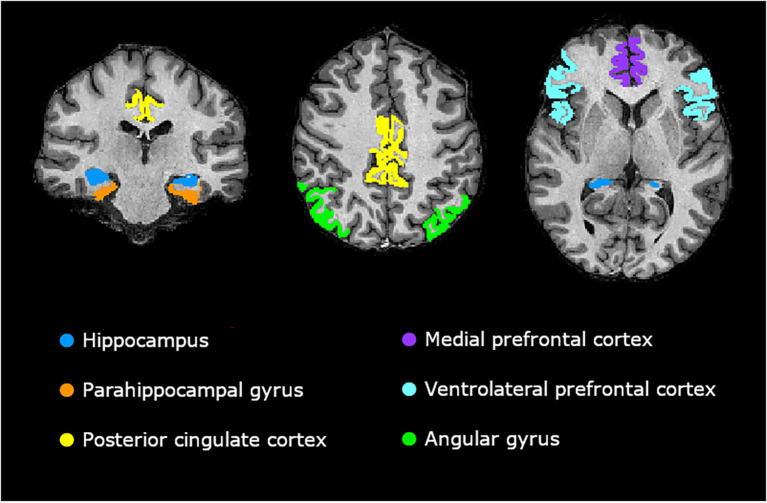 Figure 1