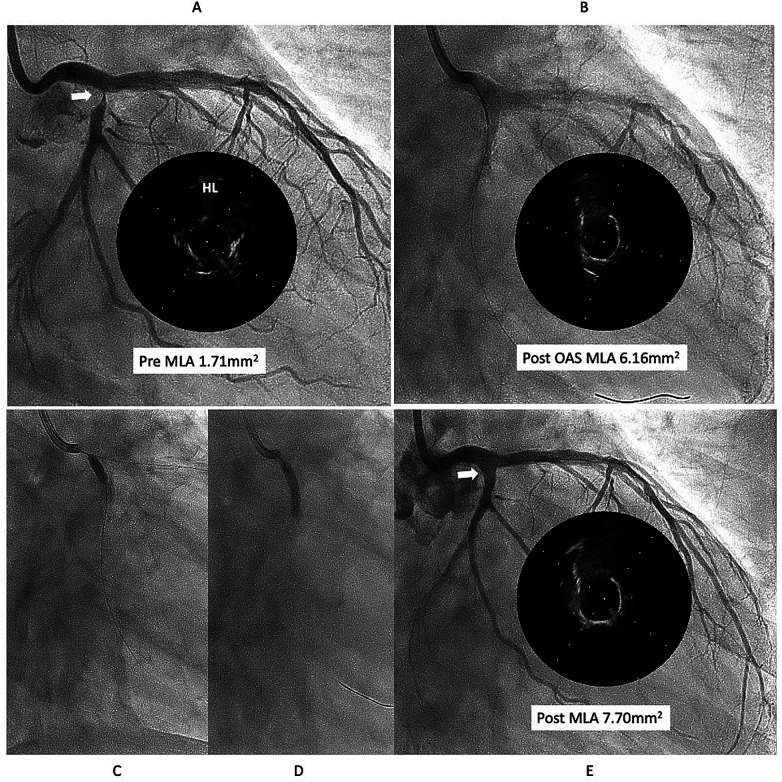 Figure 1