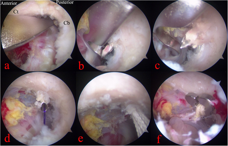 Figure 2