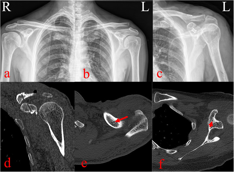 Figure 3