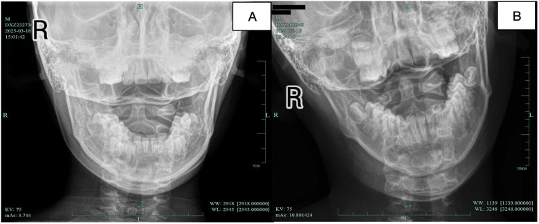 Figure 4
