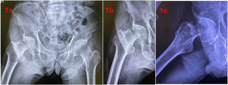 Figure 1