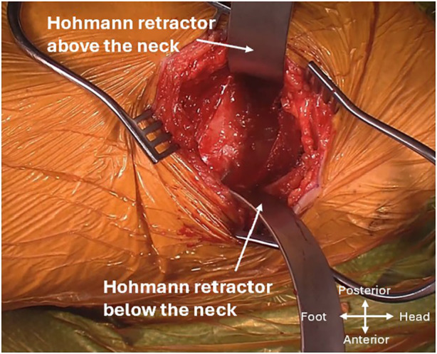 Figure 5