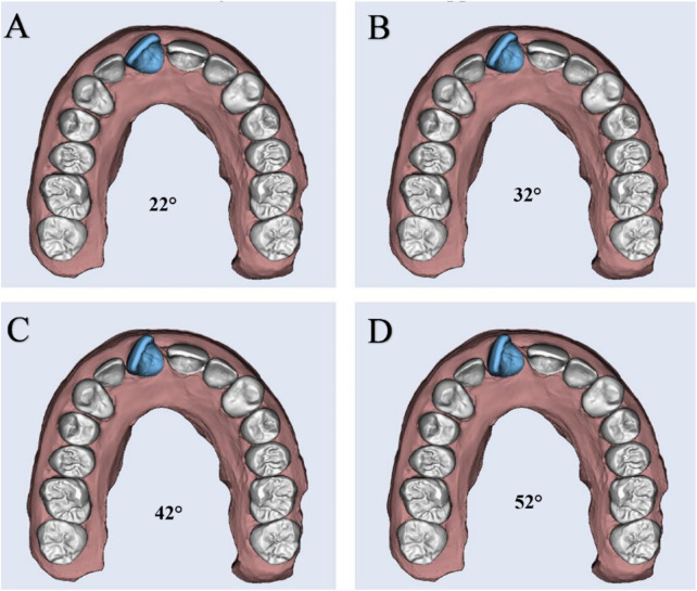 FIGURE 3