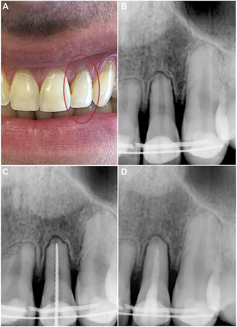 Figure 1