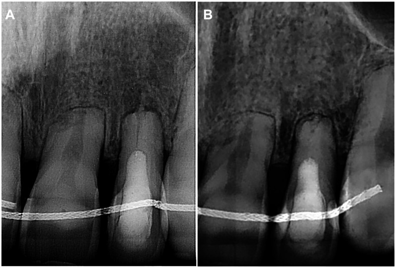 Figure 4