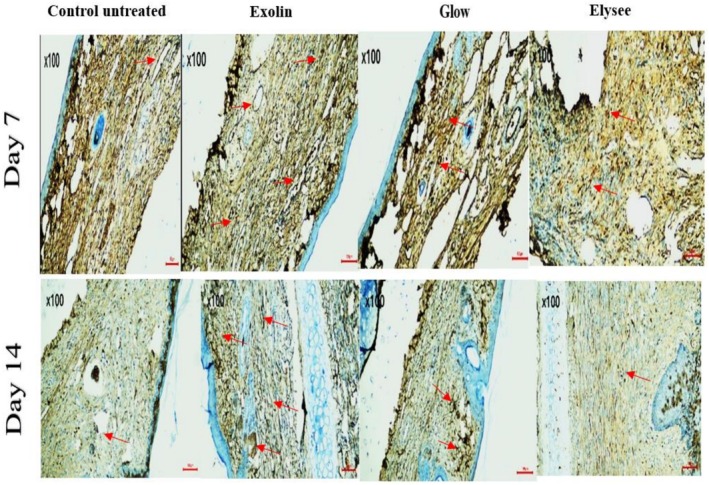 FIGURE 3